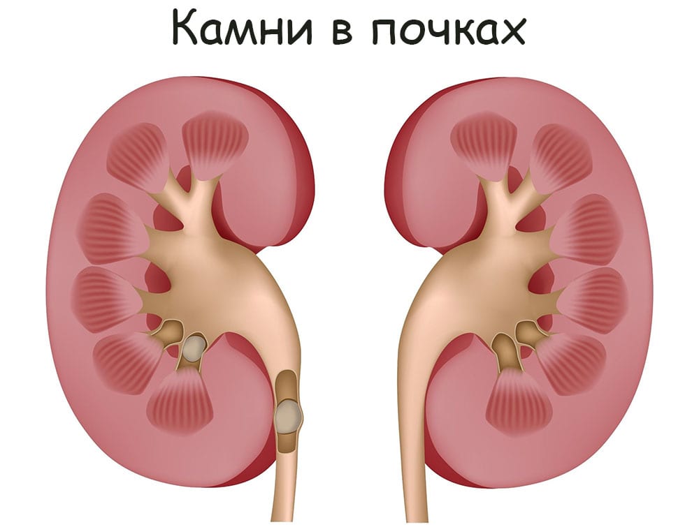 Услуги даркнета